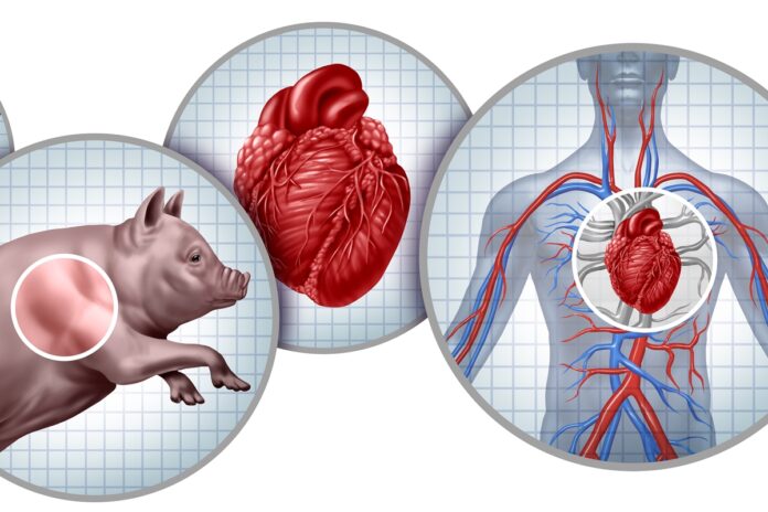 xenotransplante:-medicos-dizem-como-tecnica-promissora-avancou-em-2025