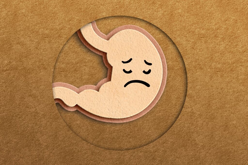 gastrite-aumenta-no-fim-do-ano?-gastros-explicam-o-que-acontece