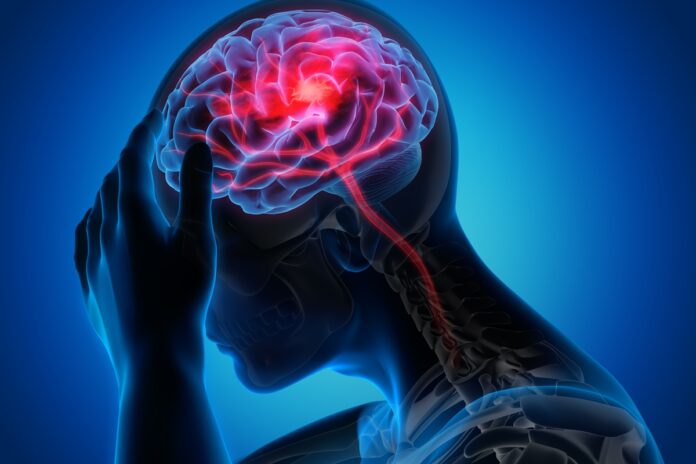 neurologistas-explicam-quais-sao-as-sequelas-mais-comuns-do-avc