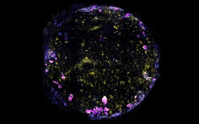 cientistas-criam-minipulmao-para-estudar-como-a-tuberculose-o-infecta