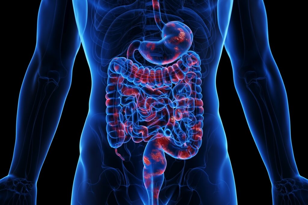 medico-ensina-como-identificar-inflamacao-ligada-a-sindrome-metabolica