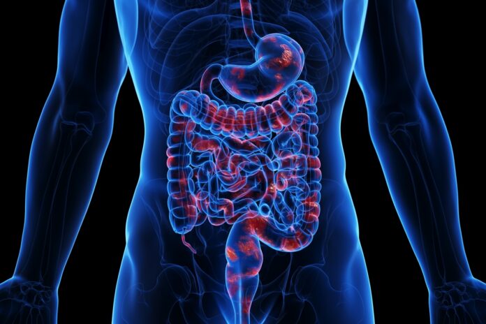 medico-ensina-como-identificar-inflamacao-ligada-a-sindrome-metabolica