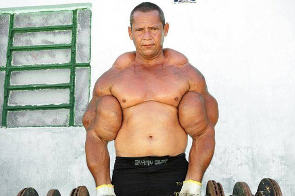 quem-era-arlindo-anomalia,-o-popeye-brasileiro-que-morreu-aos-55-anos