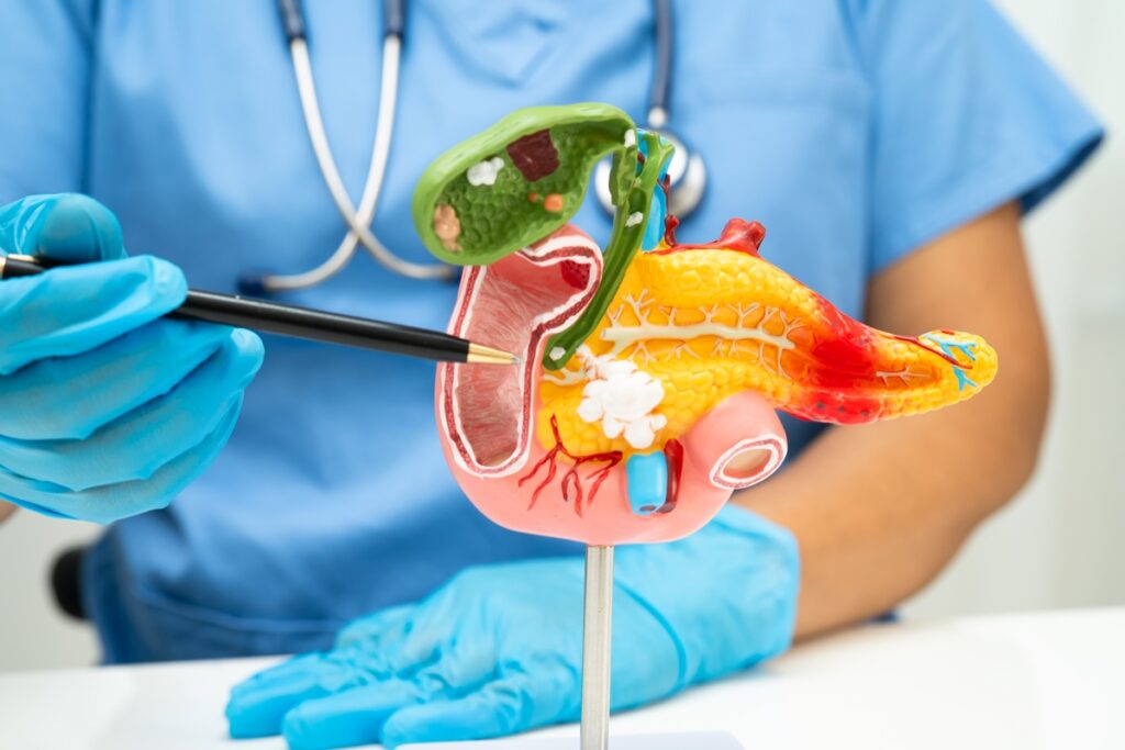 estudo-descobre-como-quebrar-disfarce-do-cancer-de-pancreas-e-ataca-lo