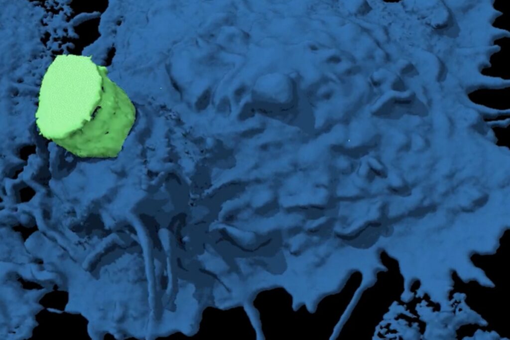 estudo-registra-celula-de-cancer-fugindo-das-defesas-do-organismo.-veja-video