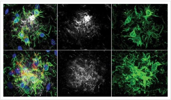 pesquisadores-descobrem-maneira-de-retardar-perda-de-memoria-no-alzheimer