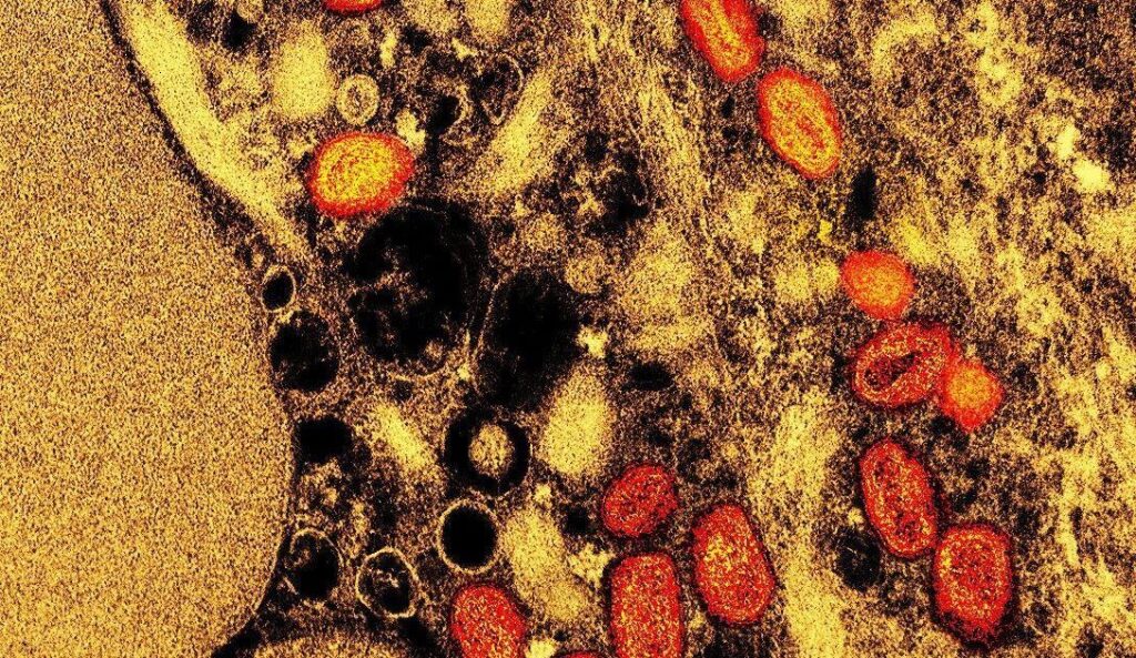 estudo-mostra-que-antiviral-mais-usado-contra-mpox-nao-e-eficaz