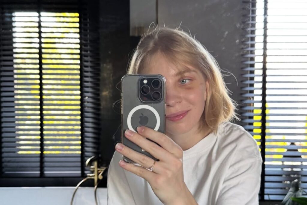 jogos-de-inverno:-patinadora-detalha-sequelas-apos-acidente-em-prova