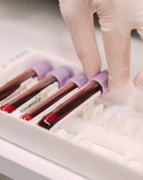 oncologia-personalizada:-futuro-do-tratamento-do-cancer,-conheca-com-kalil