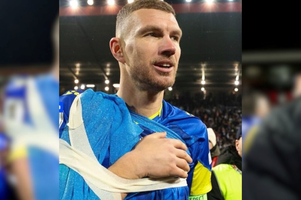 idolo-da-bosnia-tem-fratura-confirmada-e-preocupa-para-copa-do-mundo