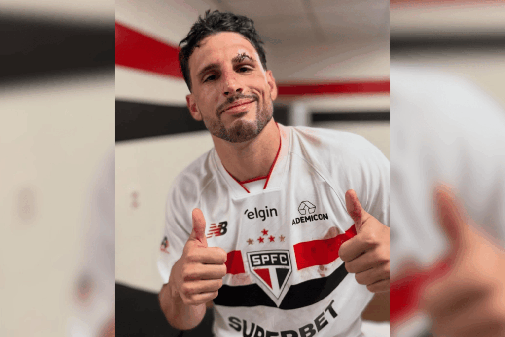 calleri-sofre-corte-no-supercilio-e-precisa-de-sutura-durante-partida