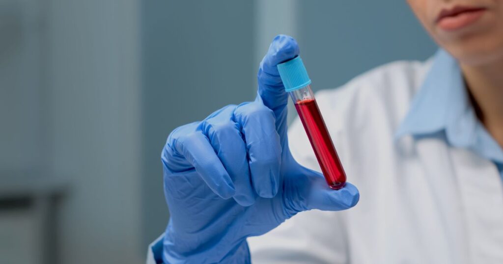 exame-de-sangue-combinado-com-ia-ajuda-no-diagnostico-precoce-de-hanseniase