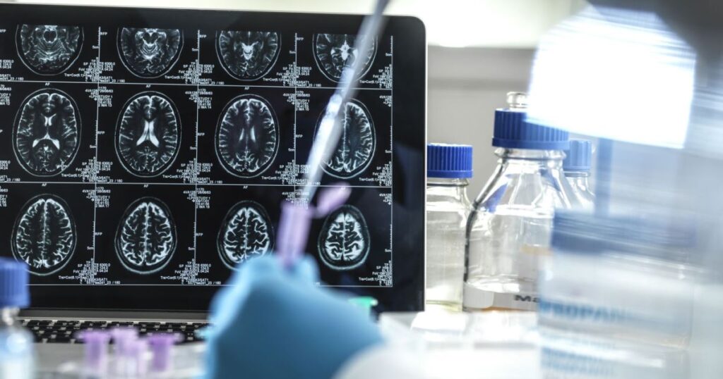 dr.-kalil-e-neurologistas-comentam-despreparo-do-brasil-com-envelhecimento