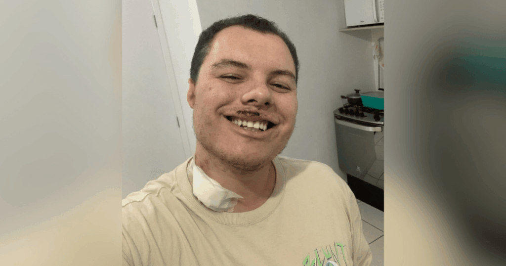 homem-agredido-em-festa-universitaria-de-sp-e-internado-novamente-apos-alta