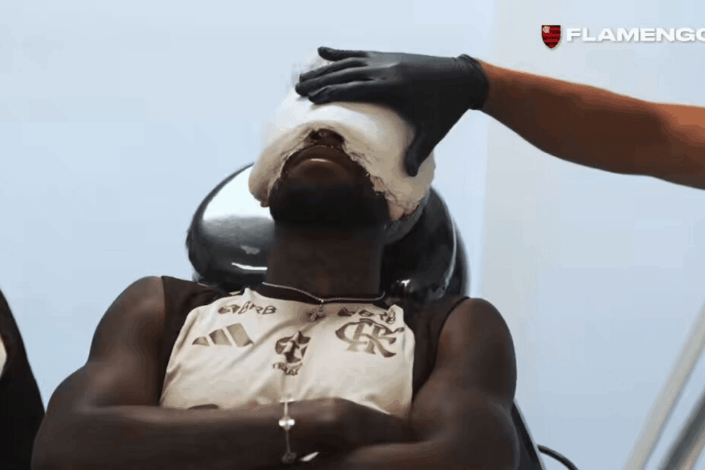 flamengo-faz-molde-facial-para-emerson-royal-atuar-contra-o-vasco