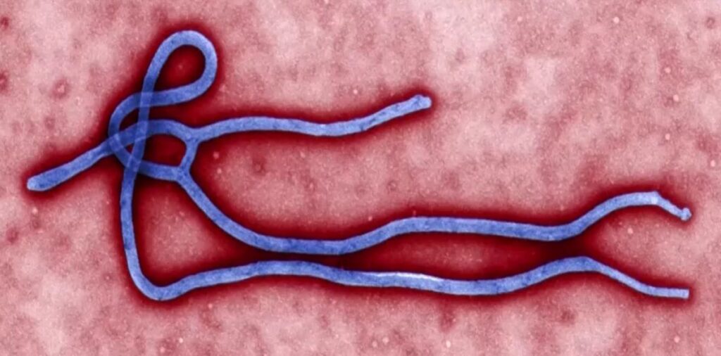 caso-suspeito-de-ebola-e-descartado-em-paciente-no-rio-grande-do-sul