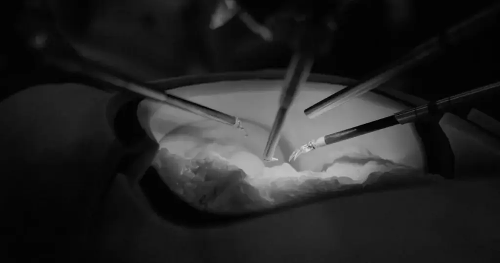 Cirurgia inédita trata doença rara pela 1ª vez no Brasil; entenda