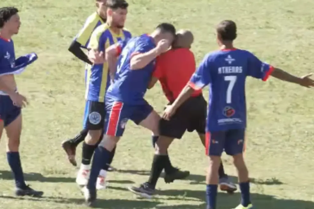 Árbitro de futebol leva cabeçada e precisará passar por cirurgia