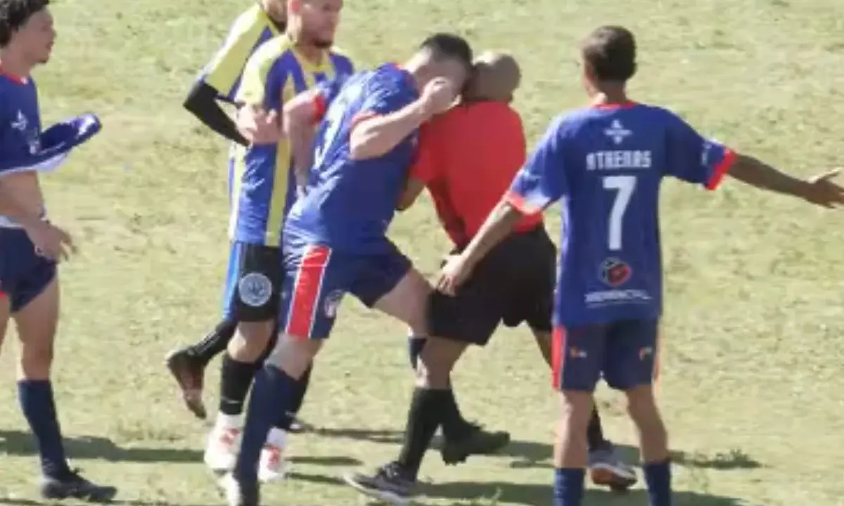 Árbitro de futebol leva cabeçada e precisará passar por cirurgia