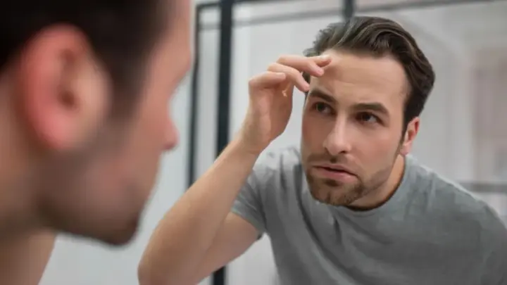 Queda de cabelo: por que cada vez mais homens buscam tratamento?
