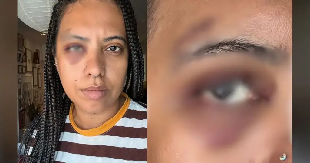 Influenciadora é agredida em samba na região central do Rio de Janeiro