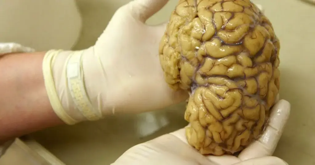 Cientistas mapeiam atividade gênica no córtex pré-frontal do cérebro, em busca de repostas para Alzheimer, Parkinson e esquizofrenia