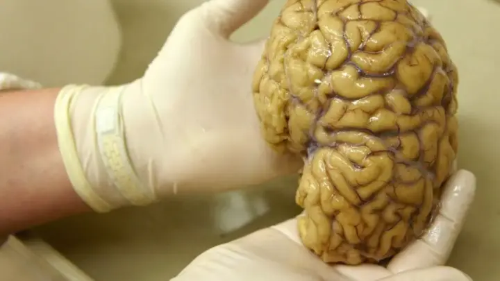 Cientistas mapeiam atividade gênica no córtex pré-frontal do cérebro, em busca de repostas para Alzheimer, Parkinson e esquizofrenia
