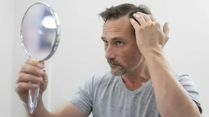 Com subida do uso de caneta emagrecedora, homens querem ajuda para calvície