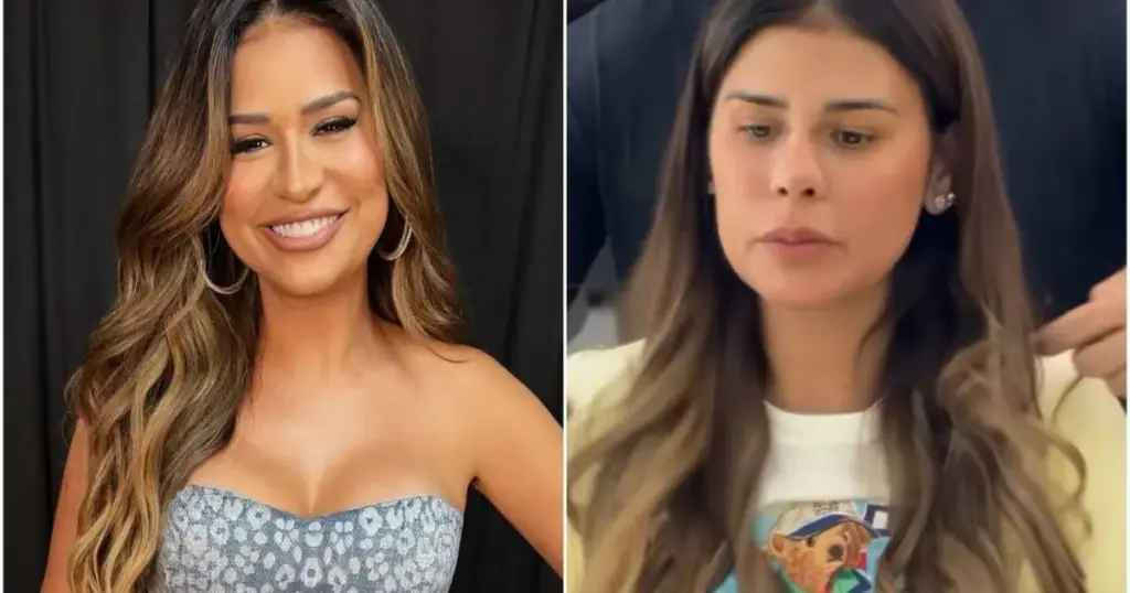 Simone Mendes faz procedimento no rosto e choca fãs: “Irreconhecível”