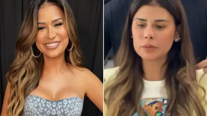 Simone Mendes faz procedimento no rosto e choca fãs: “Irreconhecível”
