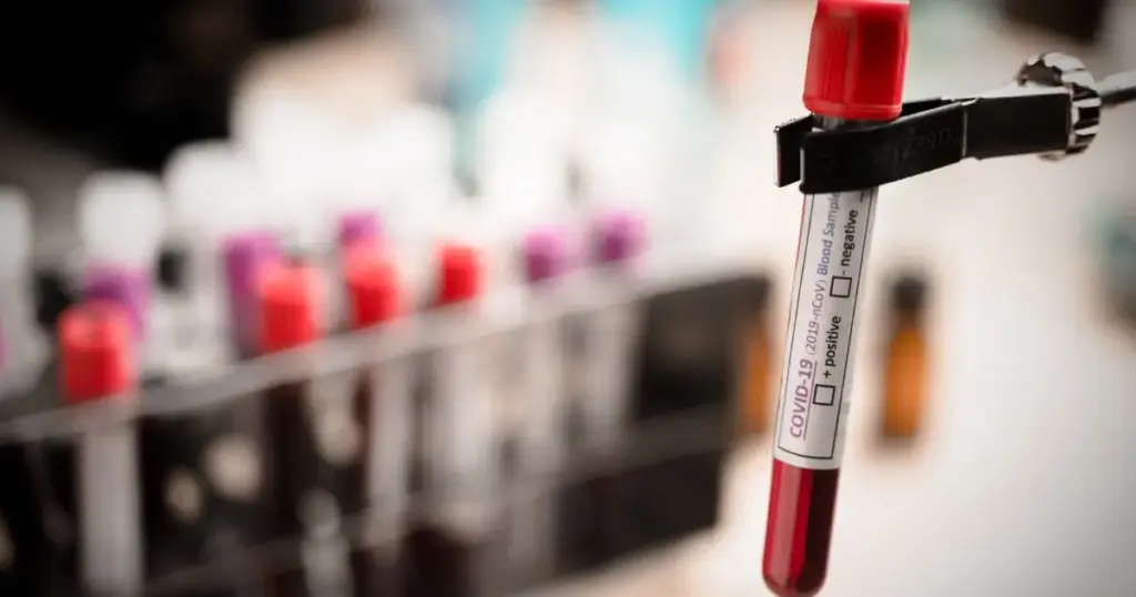 Exame de sangue que detecta mais de 50 tipos de câncer chega ao Brasil