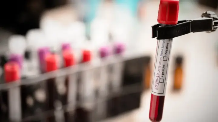 Exame de sangue que detecta mais de 50 tipos de câncer chega ao Brasil