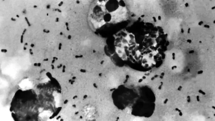 Rússia diz que nenhum caso de peste foi detectado após morte de cientista