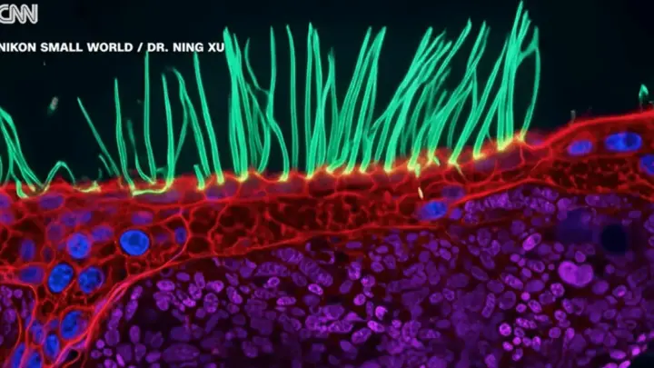Vencedor de concurso de fotografia de microscopia da Nikon enfrenta críticas pelo uso de inteligência artificial
