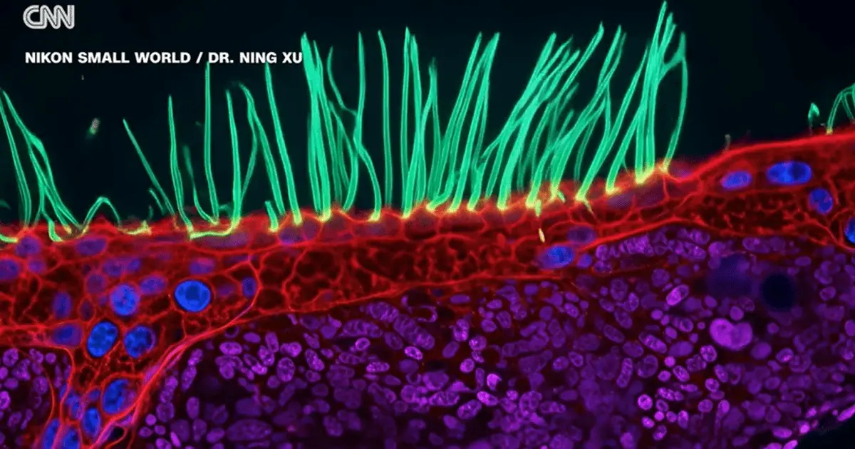 Vencedor de concurso de fotografia de microscopia da Nikon enfrenta críticas pelo uso de inteligência artificial