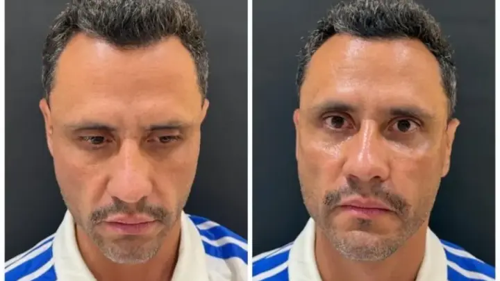 Cleitinho faz procedimento estético um dia após ser eleito governador de MG