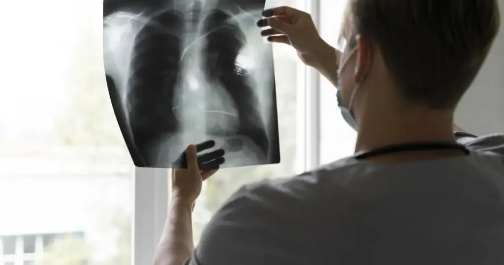 Anvisa aprova terapia-alvo para câncer de pulmão avançado; conheça