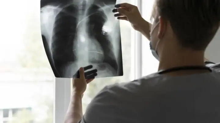 Anvisa aprova terapia-alvo para câncer de pulmão avançado; conheça