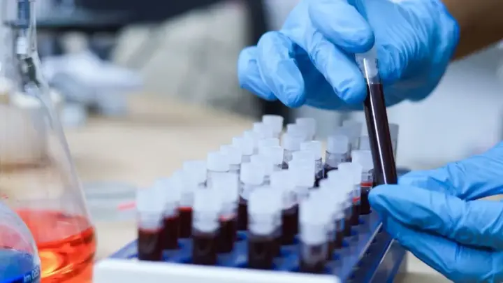 Exame de sangue capaz de diagnosticar o Alzheimer chega ao Brasil