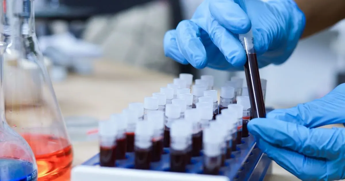 Exame de sangue capaz de diagnosticar o Alzheimer chega ao Brasil