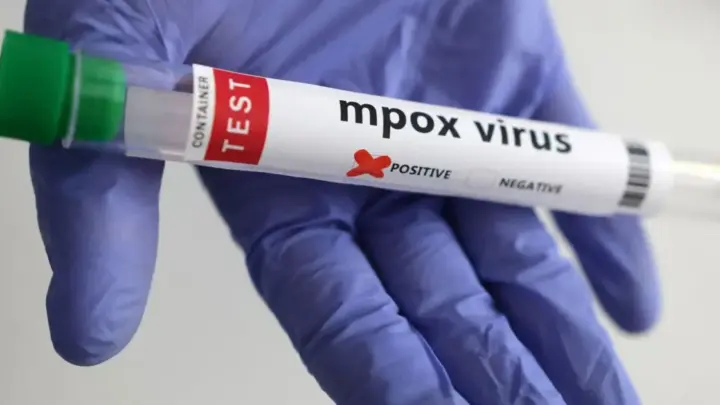 Rio de Janeiro registra 74 casos de Mpox em dois meses